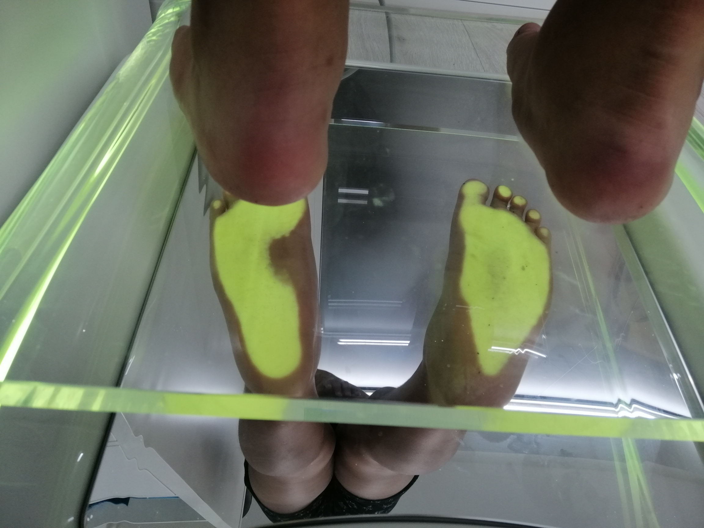 Peus d'un infant sobre el podoscopi, amb l'empremta plantar il·luminada